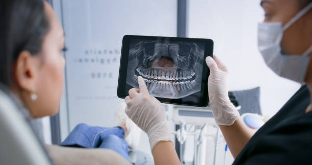 Licensed Wisdom Tooth Removal service in Middleburg Heights, OH - Smile Center Dentistry